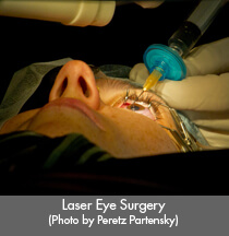 lasik3